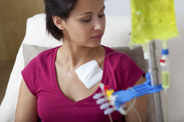 A quimioterapia pode ser aplicada por diferentes vias do corpo, tais como oral, intravenosa e intramuscular