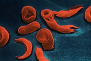 Dê Um Exemplo De Seleção Natural