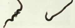 Schistosoma mansoni: platelminto responsável pela esquistossomose, ou barriga-d'água.