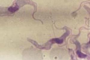 <i>Trypanosoma cruzi</i>.