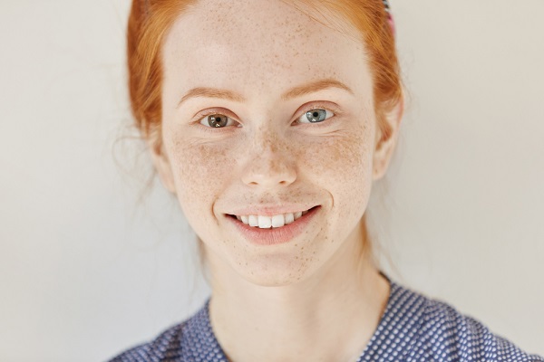 A heterocromia é uma condição em que as pessoas apresentam olhos com coloração diferente