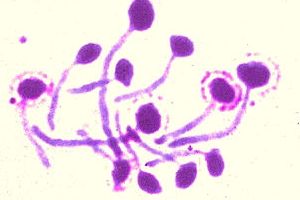 Candida albicans: fungo causador da candidíase.
