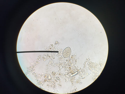 Observe na figura o ovo do Diphyllobothrium