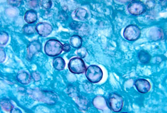Histoplasma capsulatum, fungo causador da histoplasmose