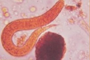 <i>Strongyloides stercoralis</i> – parasita intestinal do homem.