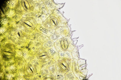 Existem diferentes tecidos vegetais. Acima vemos a epiderme, um tecido de revestimento
