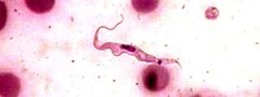 <i>Trypanosoma cruzi</i>: protozoário responsável pela doença de Chagas