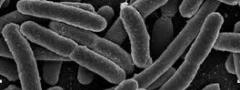 Escherichia coli: bactéria responsável por problemas gástricos e intestinais.
