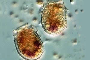 <I>Dinophysis acuminata</I>: dinoflagelados que possuem toxinas.